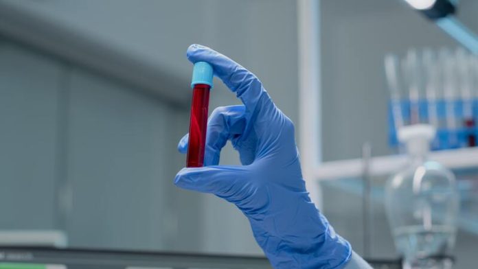 pénurie sang don du sang en chute libre japon fabrique sang artificiel universel humain Ma Santé Un chercheur japonais en train de créer du sang artificiel humain dans un laboratoire.