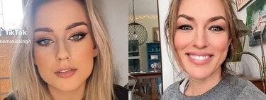 "Put this filter": As TikTok is driving the demand for aesthetic surgeries among young women
