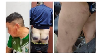 The blows suffered by the detainees are documented
