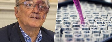 A Spanish milestone against pancreatic cancer: we are one step closer to eradicating it but there is still a long way to go