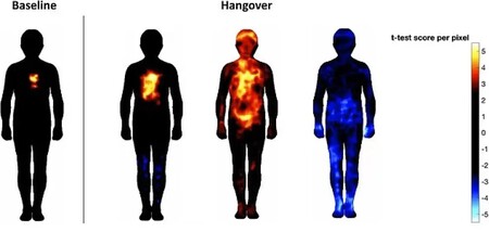Hangover Pain Map