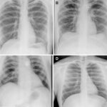 A Group of Astronauts Without Medical Training Achieves the World’s First X-ray in Orbit: A Remarkable Breakthrough