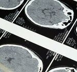 Science Reveals How the Sauna “Hacks” the Brain: It Reduces Alzheimer’s Risk by 65%