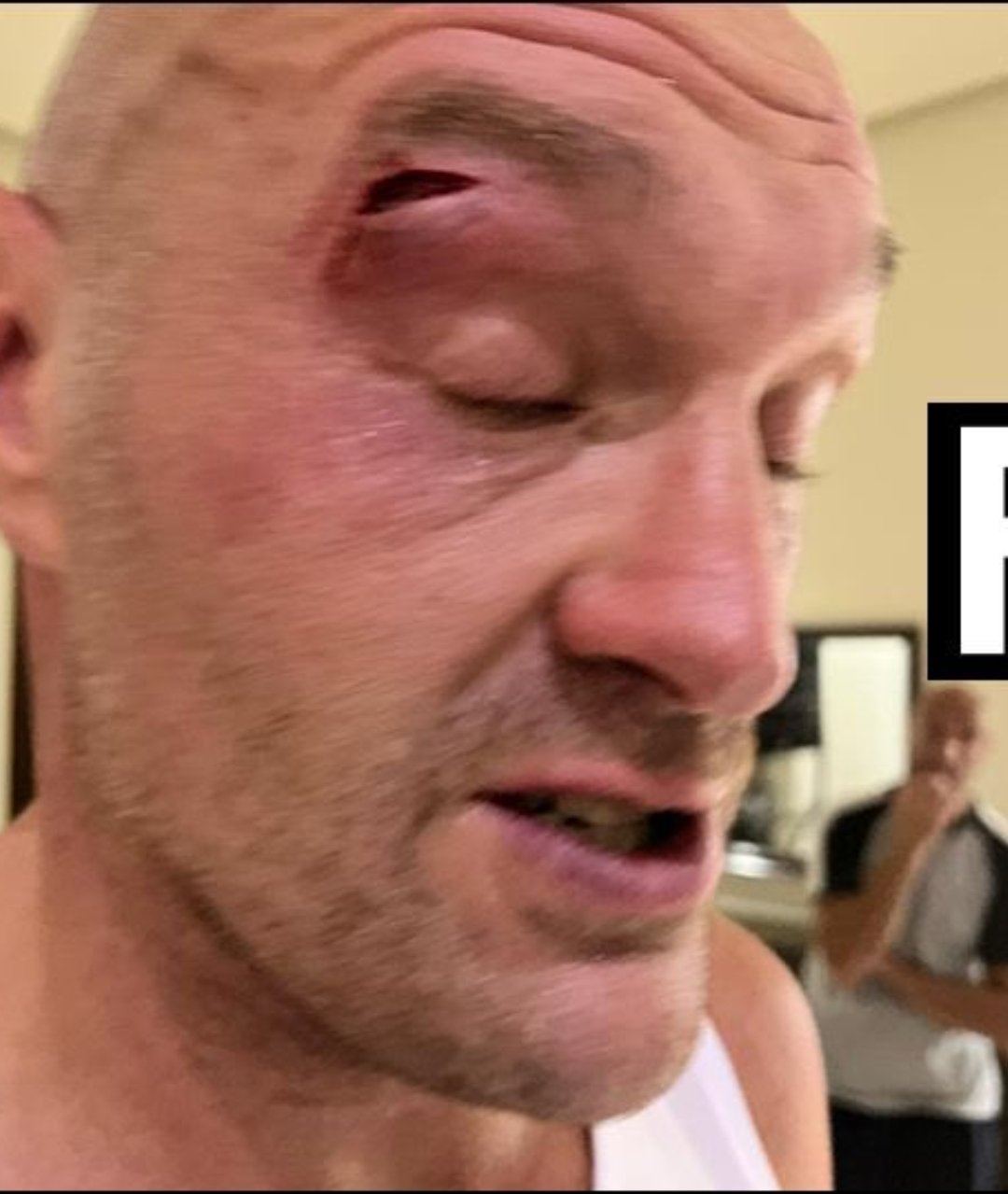 Tyson Fury sufrió un corte que pospuso la pelea con Usyk de su fecha original el 17 de febrero