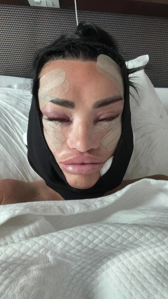 Mostraron su reciente proceso de lifting facial con gran detalle gráfico