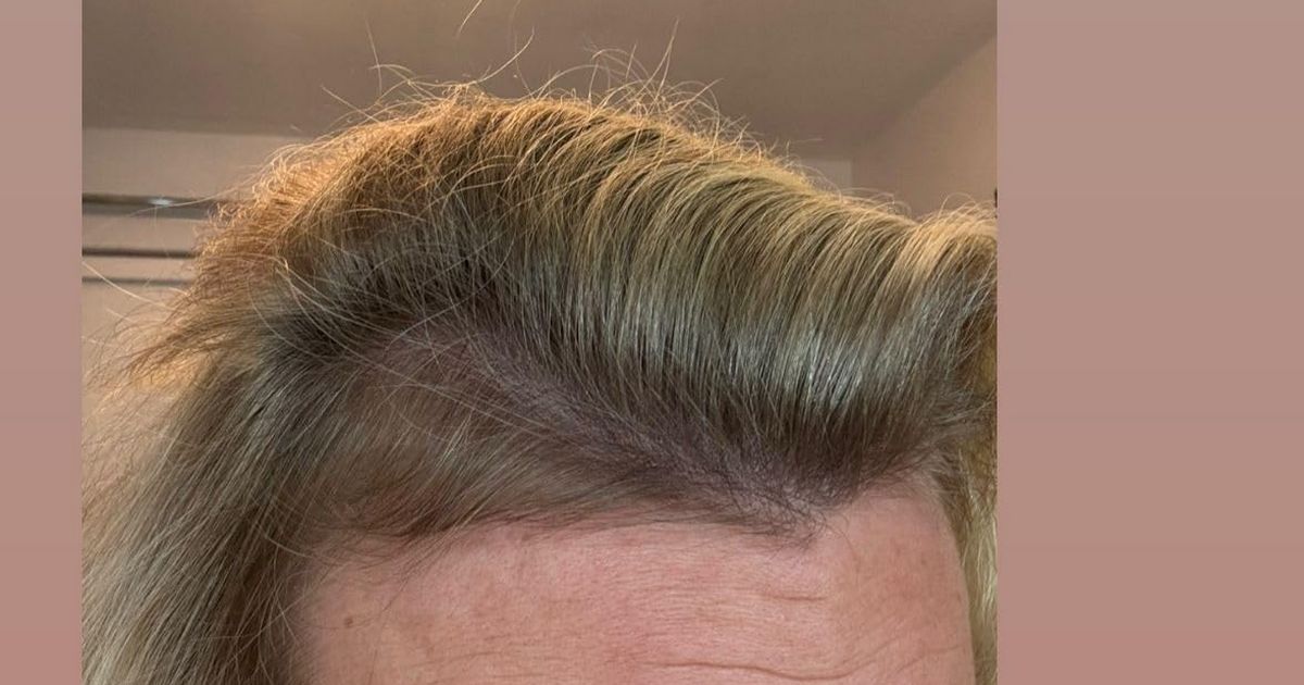 El suplemento de crecimiento del cabello de 'cura milagrosa' hace