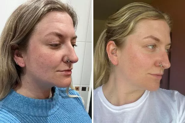 Revisión de máscara facial de Silk'n LED EMS