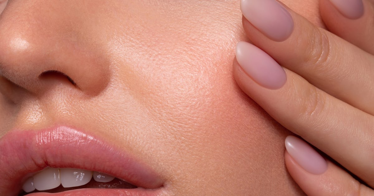 Brotes después de que los tratamientos faciales son más comunes