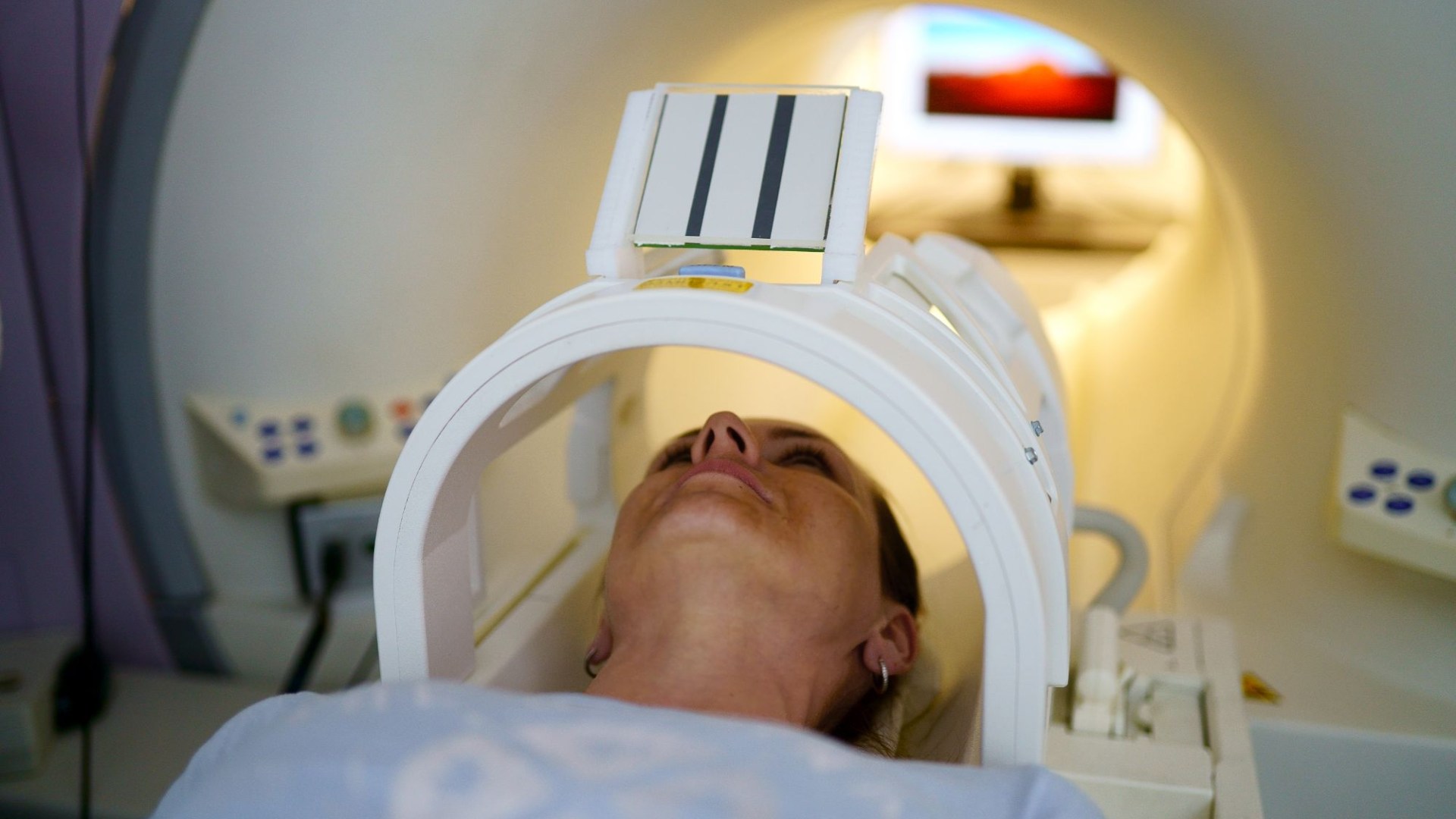Su riesgo de ataque cardíaco y accidente cerebrovascular se puede