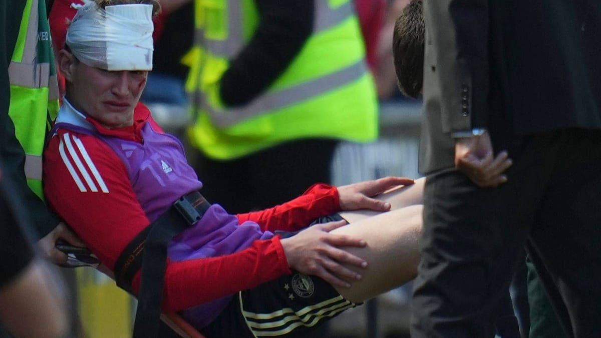 Escocia: Fan lanza Shell de asiento y conoce a su