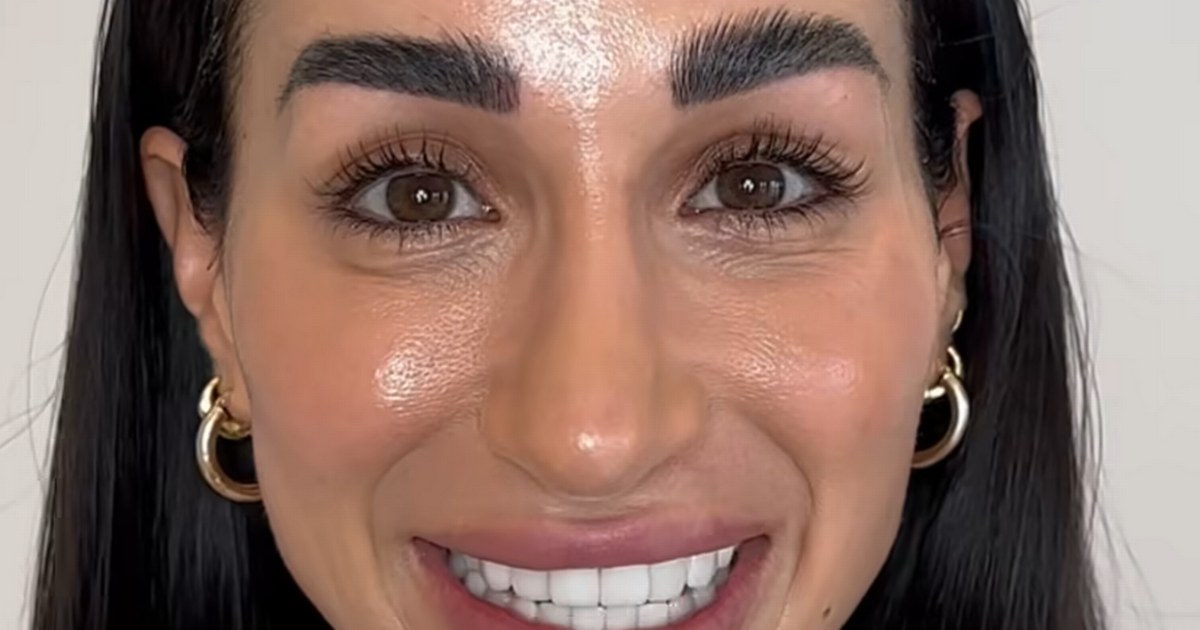 Dermatóloga dice que no es necesario 'rehacer Botox' tan pronto