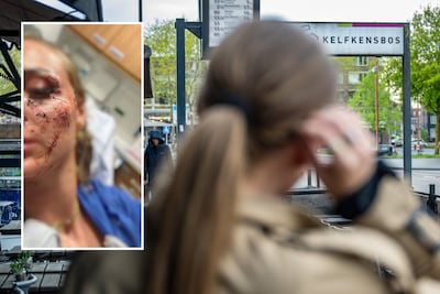 Cicatrices visibles, perpetrador invisible: Lotte (25) fue seriamente maltratada durante