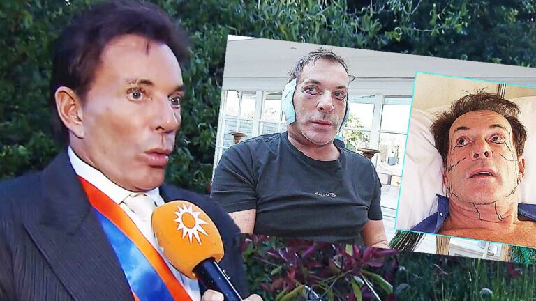 Después de seis horas de operación: New Face Gerard Joling