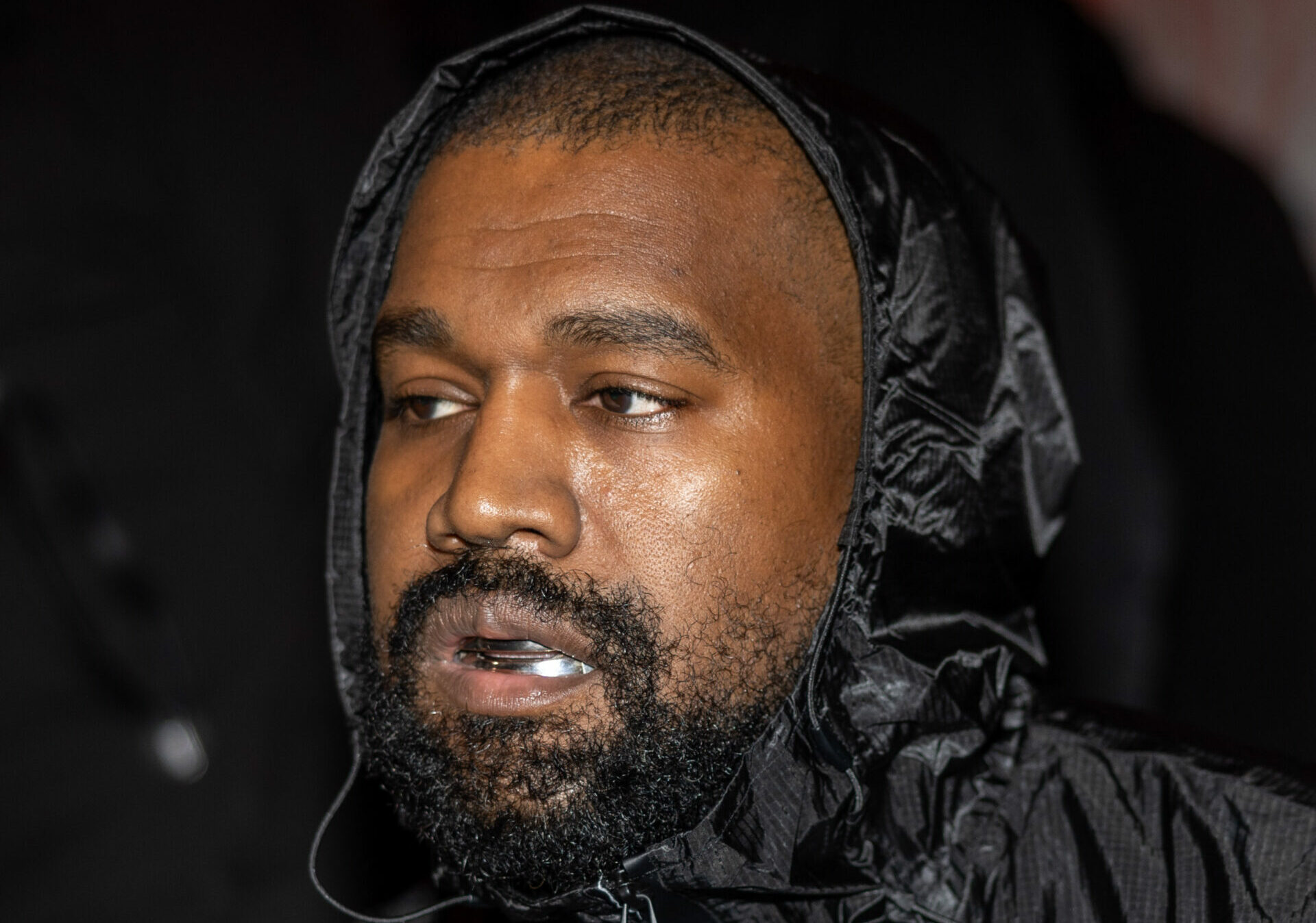 Kanye West quiere demandar al ex dentista- "Lachgas me arruinó"