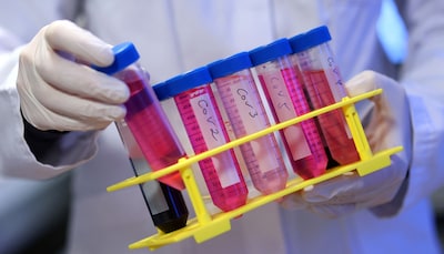 Los investigadores descubren que aumenta el riesgo de covid de