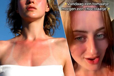 Los jóvenes se protegen (conscientemente) muy poco contra el sol: