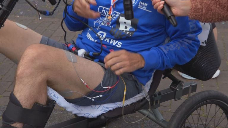 Electrodos en las piernas de Peter (Foto: Omroep Brabant).