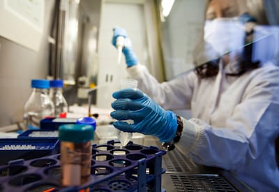 Presumiblemente caso de ébola en la República Checa: el hombre