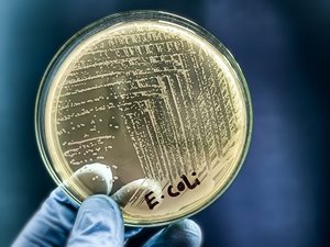 DECODIFICACIÓN. Intoxicaciones alimentarias mortales: E. coli, Listeria, botulismo… ¿están aumentando