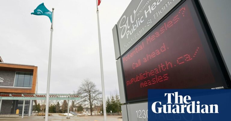 Canadá: bebé prematuro muere de sarampión en medio del brote