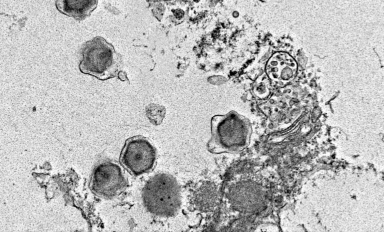 Científicos descubren cientos de nuevos virus gigantes que podrían amenazar