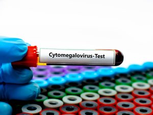 Cytomegalovirus: la HAS recomienda el cribado sistemático en mujeres embarazadas