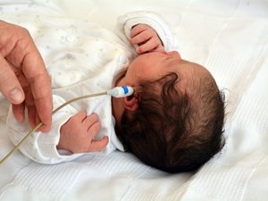 Detección de la sordera neonatal: la HAS emite nuevas recomendaciones.