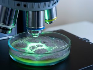 E. coli: casos raros pero complicaciones peligrosas