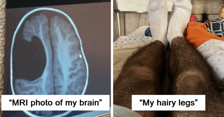 «El pelo creció en el ojo»: 86 fotos impactantes que