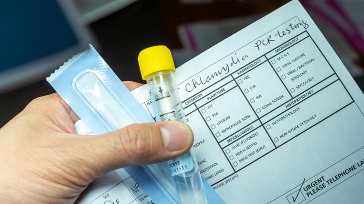 Frente al aumento de las infecciones sexuales, un kit de