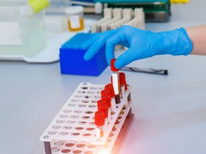 Investigadores franceses descubren un nuevo grupo sanguíneo.