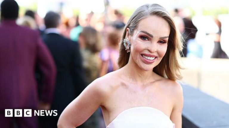 Katie Piper: "El envejecimiento se puede comparar a un duelo."