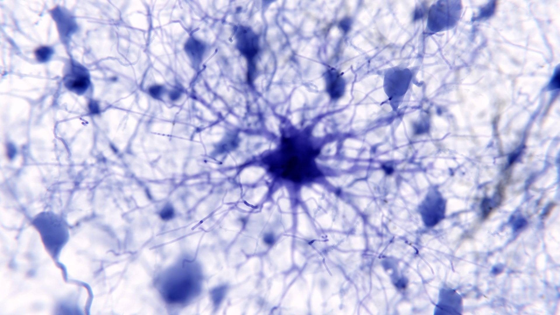 Las células cerebrales en forma de estrella pueden ser la