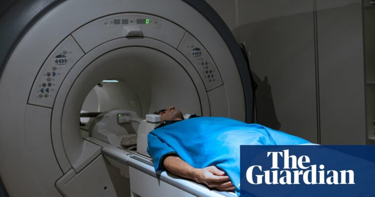 Millones en el oeste no saben que tienen enfermedad hepática
