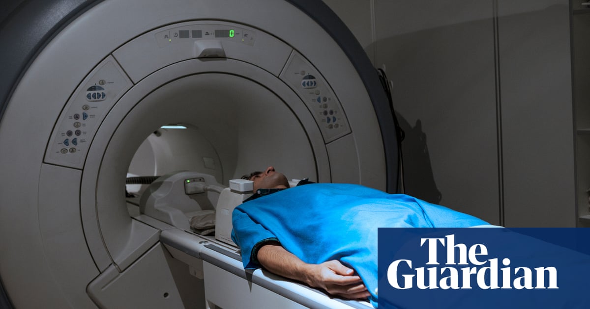 Millones en el oeste no saben que tienen enfermedad hepática