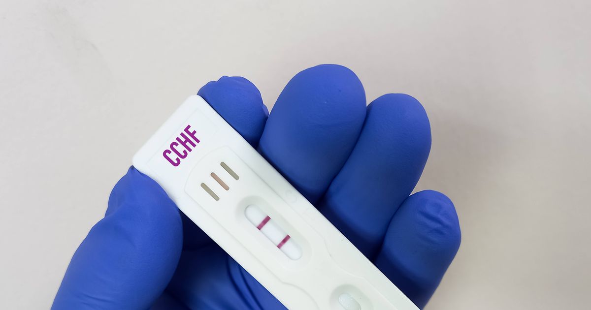 Nueva cepa de COVID con síntomas diferentes descubierta en el