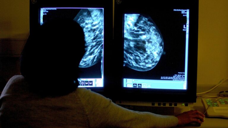 Nueva droga 'transformadora' podría detener los tumores de cáncer de