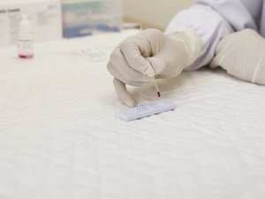 SIT: ¿cuándo hacerse el test?