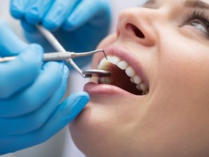 Salud bucodental: 5 mitos sobre los dientes