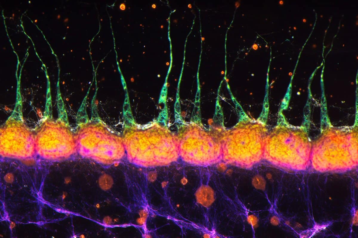 Las neuronas inhibitorias pueden ser la clave para el aprendizaje