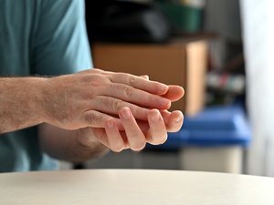 Amputado de las cuatro extremidades, un doble trasplante le permite