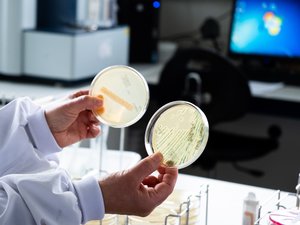 Intoxicación mortal por E. coli en Aisne: 30 casos en