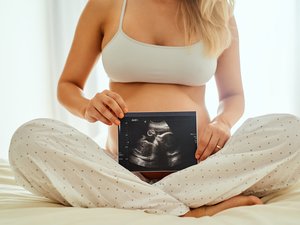 La endometriosis, relacionada con una tasa de embarazo cuatro veces