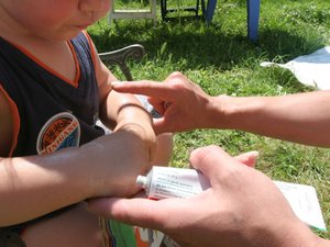 Dengue autóctona en Lalbenque: primer caso en Lot, transmisión considerada