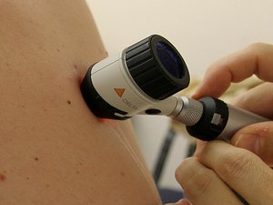 Escasez de dermatólogos: "Hace 15 años éramos 4,000, ahora somos