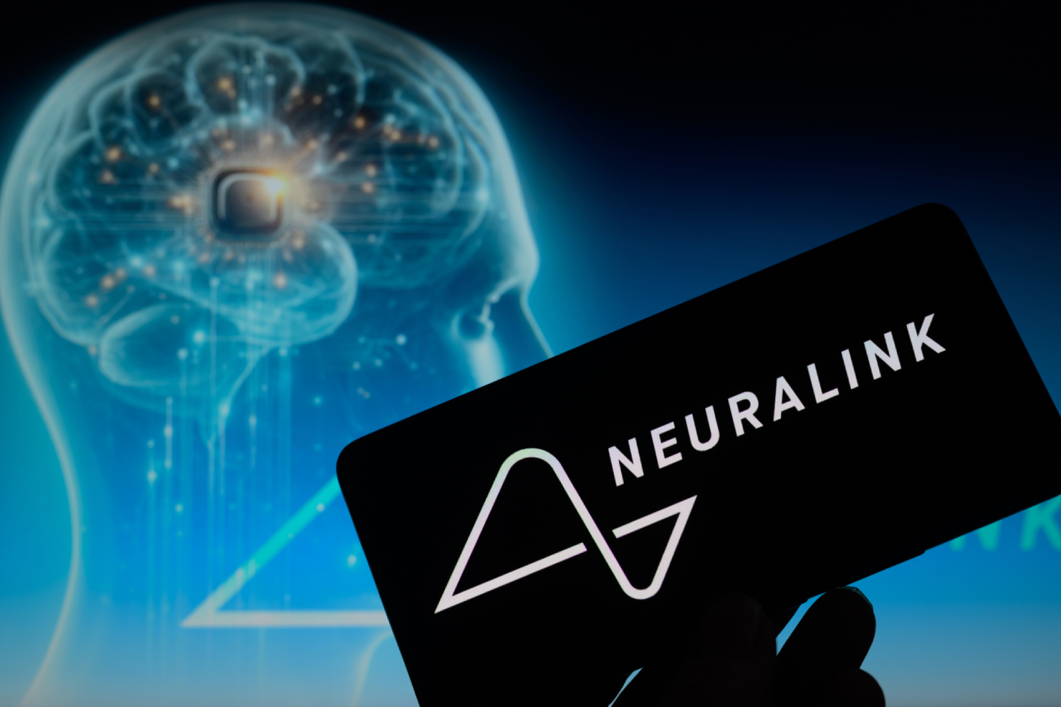 12 personas tienen ahora un implante Neuralink en su cerebro,