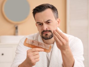 ¿En qué punto estamos en el tratamiento de la calvicie?