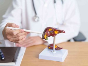 Cáncer de hígado: las desigualdades sociales cuestan cientos de vidas