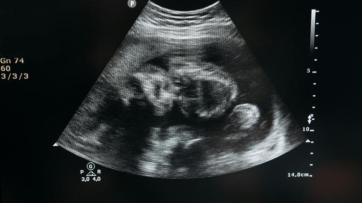 Esta familia estadounidense acogerá a una niña por primera vez