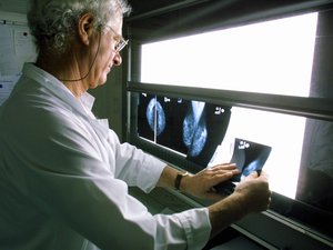 VERDADERO O FALSO. Cáncer: ¿Francia es uno de los países